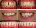 /album/galeria-de-fotos%3a-servi%c3%a7os/dentistica-restauradora-clip-image002-0000-jpg/